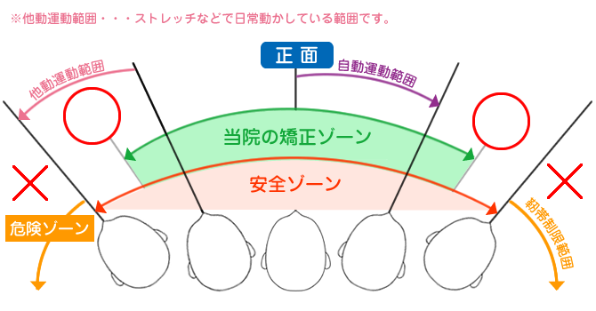 当院の矯正とは